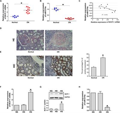 miR-374a Regulates Inflammatory Response in Diabetic Nephropathy by Targeting MCP-1 Expression